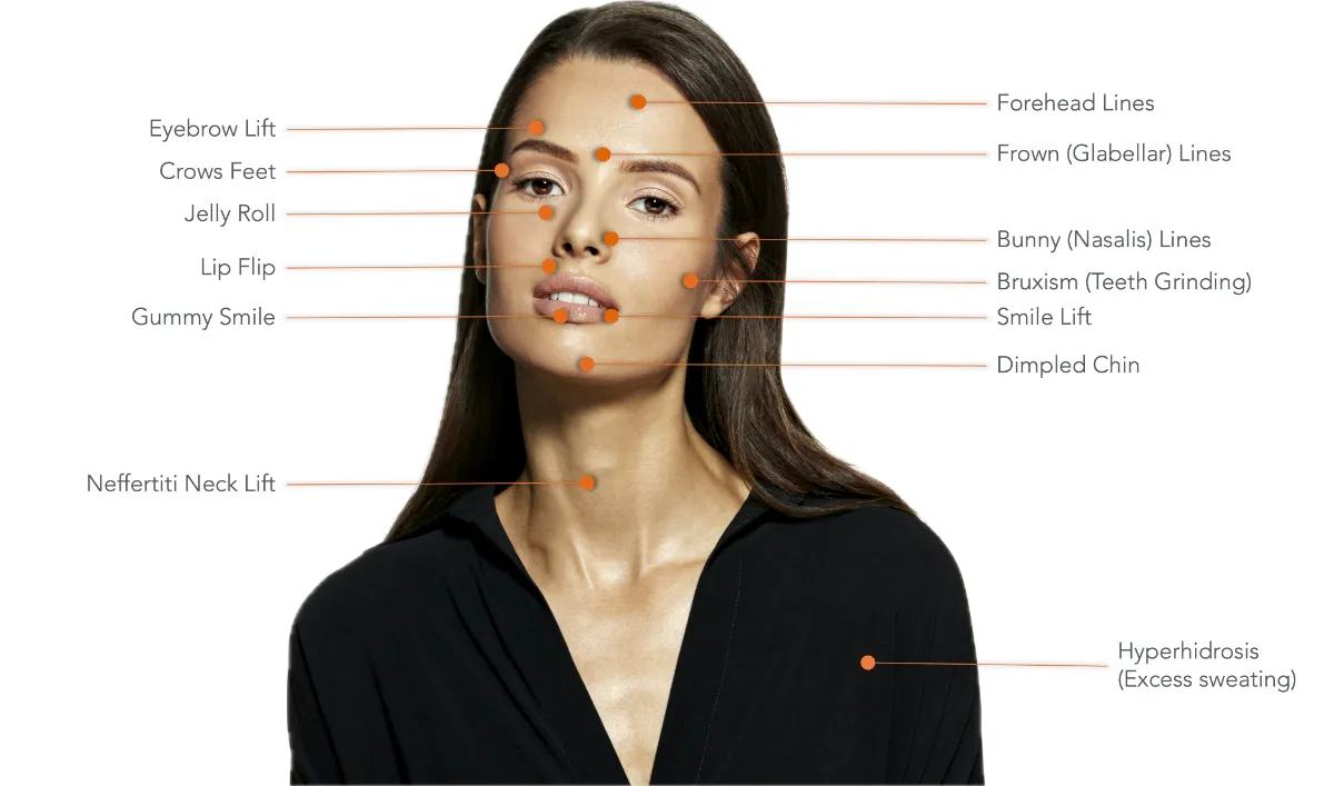 Anti-Wrinkle Injections at The London Road Clinic, Newark