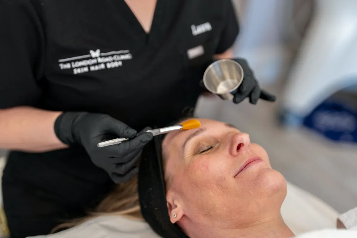 Chemical Peels at The London Road Clinic