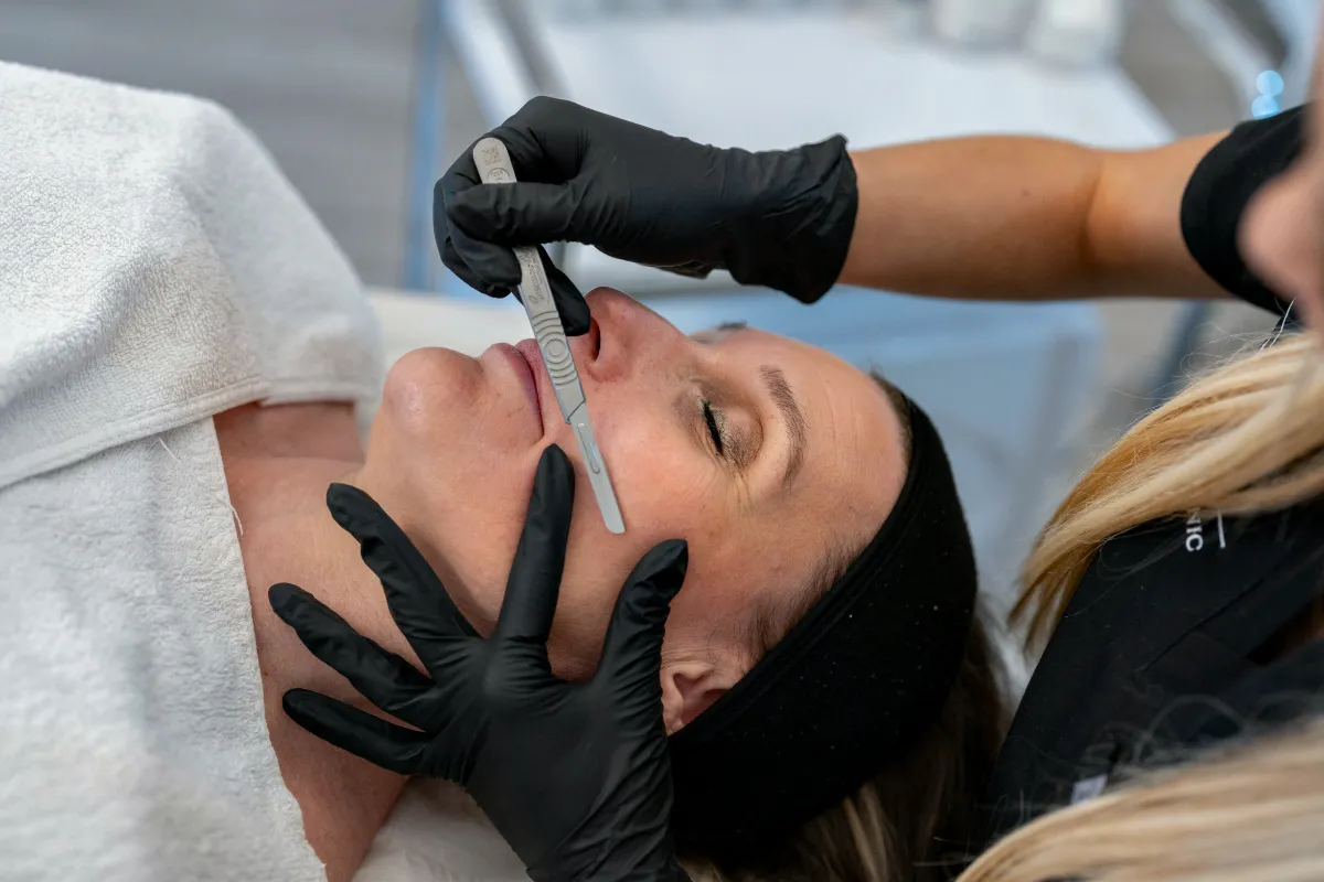 Dermaplaning at The London Road Clinic, Newark