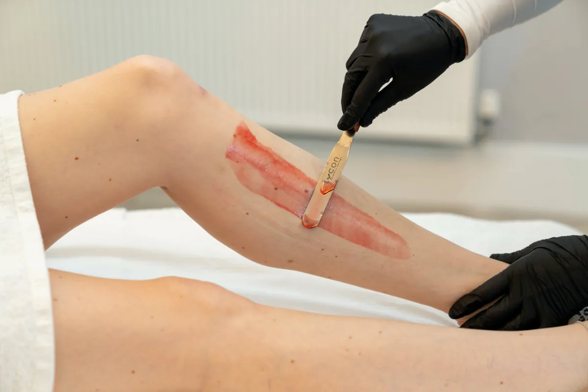 LYCON Waxing at The London Road Clinic, Newark